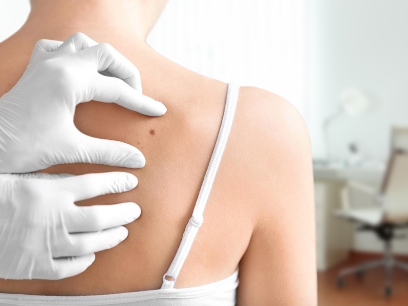 Kožní ambulance - MUDr. Alena Všetulová